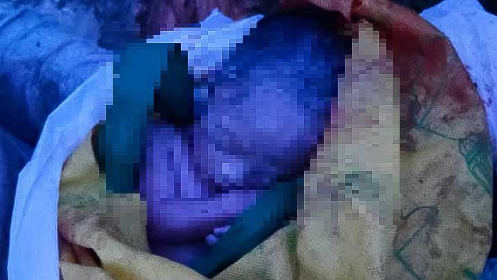 Sosok bayi laki-laki yang ditemukan di tempat sampah oleh petugas kebersihan di Kelurahan Sodohoa, Kecamatan Kendari Barat, Kota Kendari, Senin (7/2/2022). Foto/ist